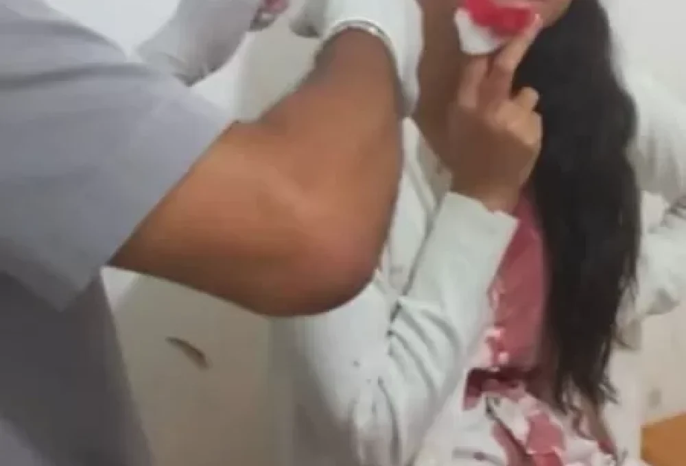 A estudante Stefani Firmo é atendida em hospital após ter o rosto cortado enquanto dormia numa viagem de ônibus de Recife a Salvador
— Imagem: Reprodução/Instagram