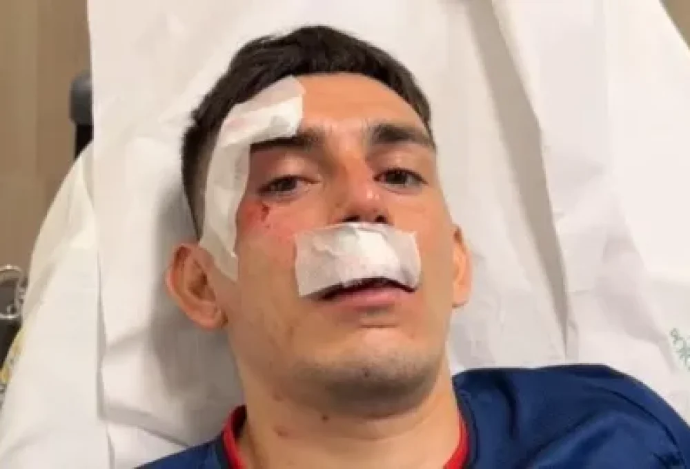 Gonzalo Escobar, lateral de 26 anos, foi um dos feridos no ataque ao ônibus do Fortaleza (Reprodução/Instagram @marcelopaz)